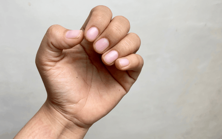 O que suas unhas estão tentando contar sobre sua saúde