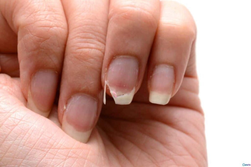 Unha quebrou? Veja como salvar sem cortar no cotoco Unha quebrou? Veja como salvar sem cortar no cotoco