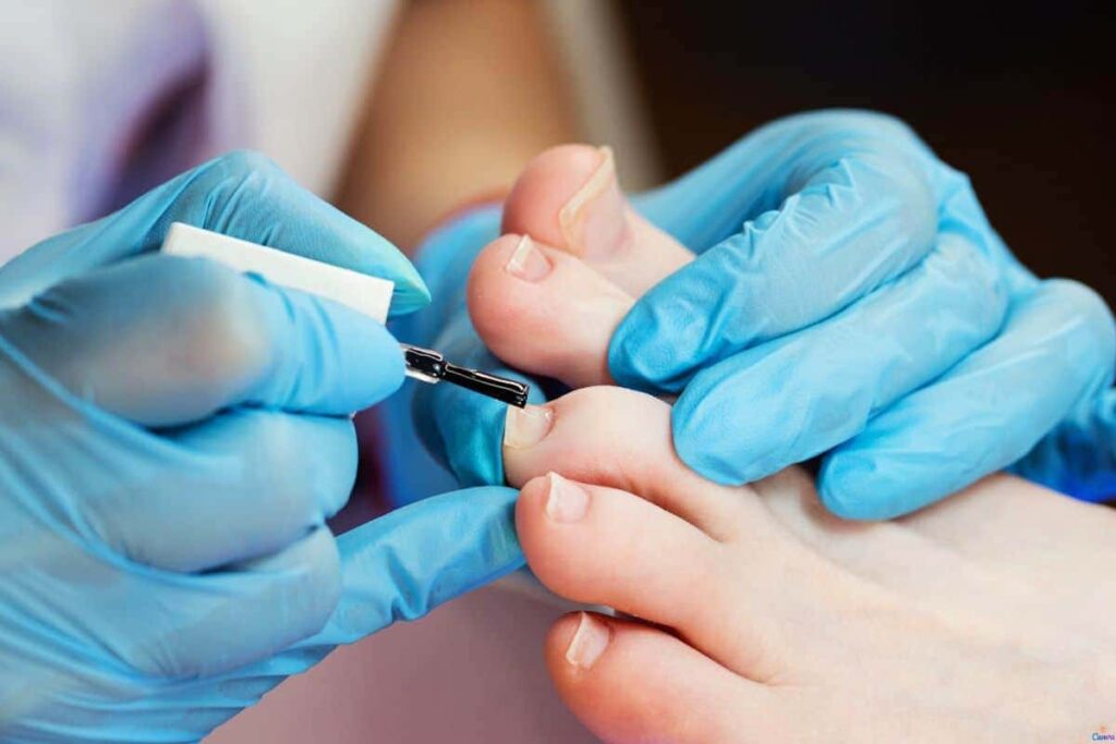 Como manter unhas dos pés bonitas e leves sem esforço