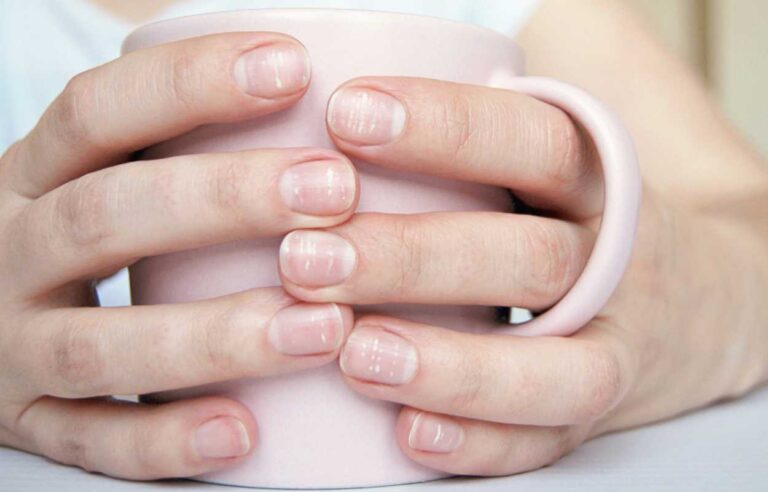 Como deixar as unhas lisas e sem ondulações
